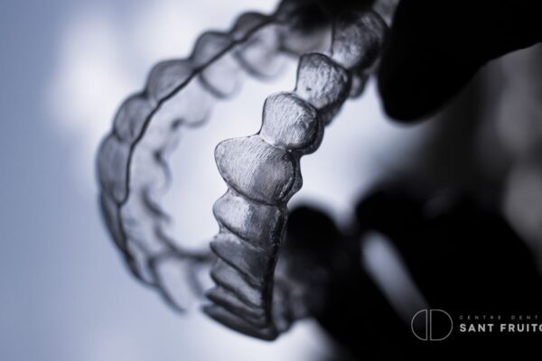 ortodoncia-invisible-antes-de-las-carillas-dentales