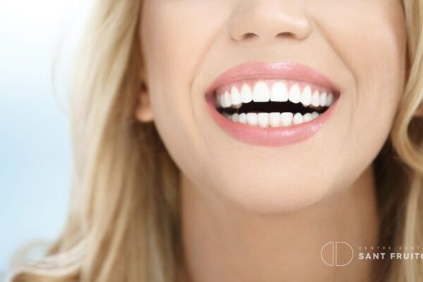 Tratamiento de la sonrisa gingival