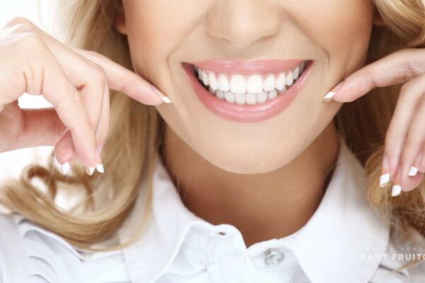 Tratamientos de estética dental